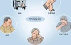 睡前有这5种表现，可能是脑梗
