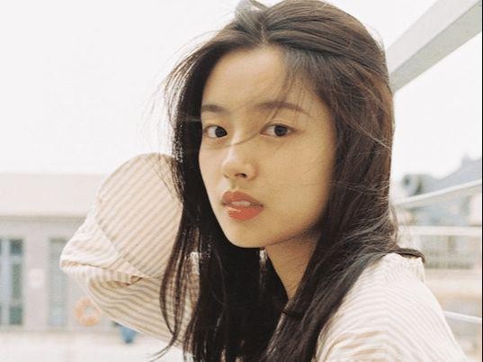微凸嘴有些娇媚感，门牙过于显眼，长相有特点的演技派女演员