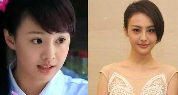 那些脸上明显动过刀的女明星，八卦群众讨论结果