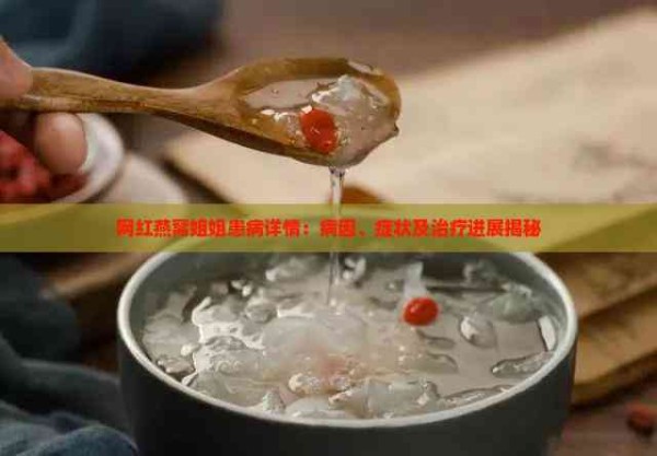 网红燕窝姐姐患病详情：病因、症状及治疗进展揭秘