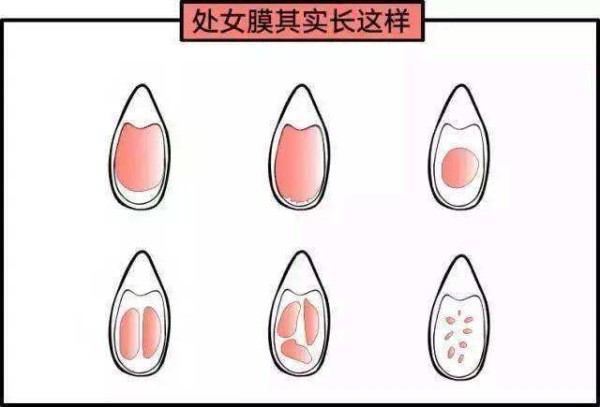 处女膜用处