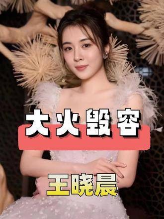 王晓晨曾与张嘉译胡歌演亲密戏,为何选择嫁给俞灏明