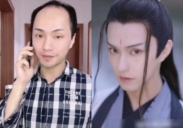 网红楚淇被粉丝喊话：请把假发焊死，与明星同框，暴露真实颜值