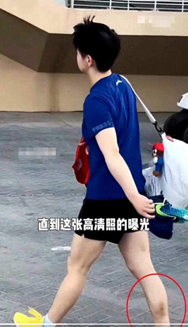 孙颖莎腿伤引热议，残酷竞技背后的伤痛，我们该如何保护运动员？