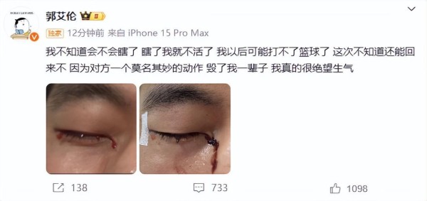 郭艾伦眼伤惊魂：篮球梦与职业安全的脆弱平衡