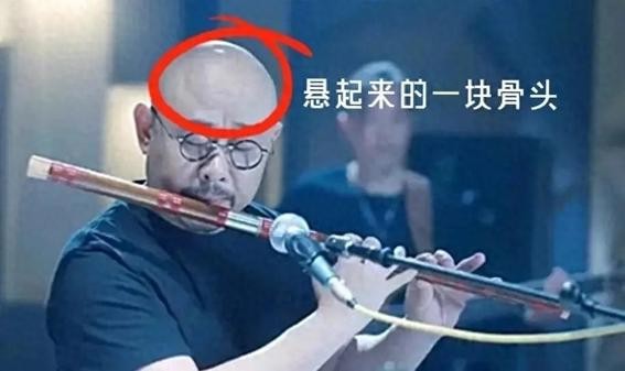 刀郎天生异相：那么他头上隆起的那块骨头，是伏羲骨还是反骨呢？