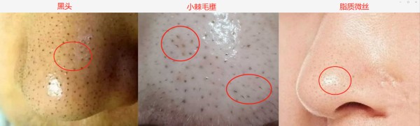 如何养出女明星那样细腻的好皮肤？最关键是做对这7点，全教给你
