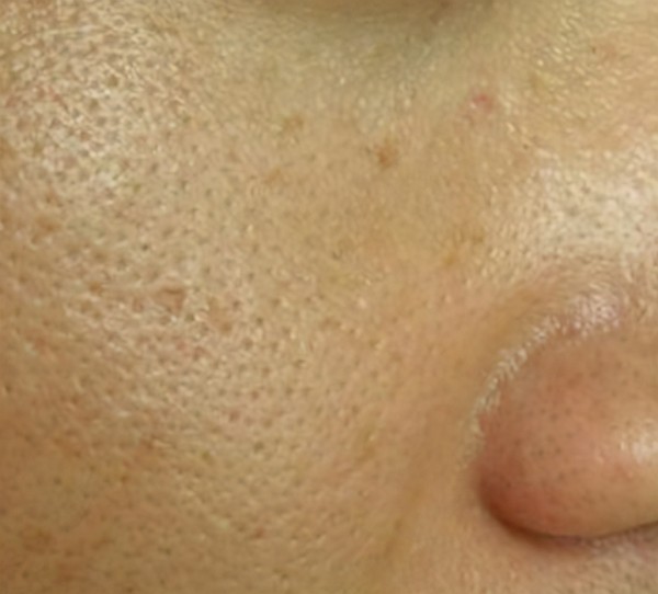 如何养出女明星那样细腻的好皮肤？最关键是做对这7点，全教给你