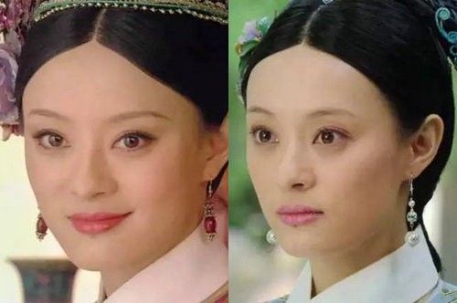 孙俪嘴唇下面的痣本来就有吗为什么不点掉?女性唇下痣面向解读
