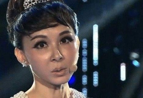 被玻尿酸毁掉的4位女明星，李小璐“惨不忍睹”，她整成”妖怪“