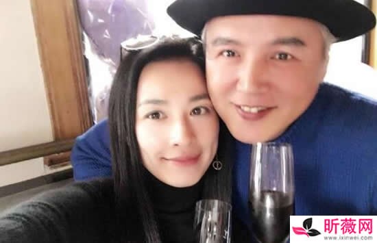 张庭个人资料简介及最新图片介绍