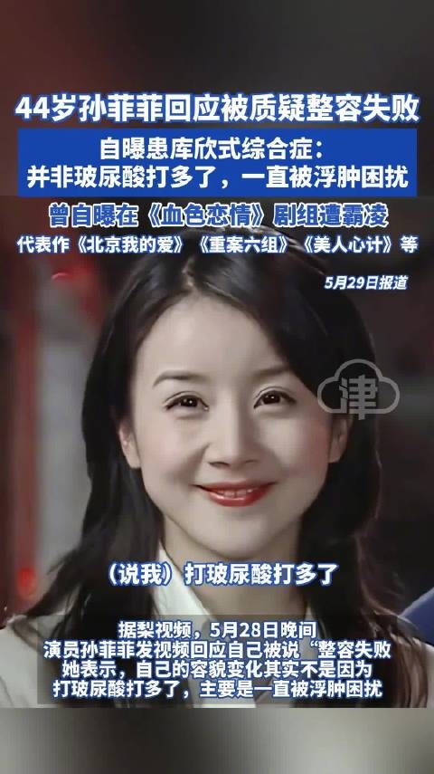 孙菲菲回应整容质疑,自曝患库欣式综合症