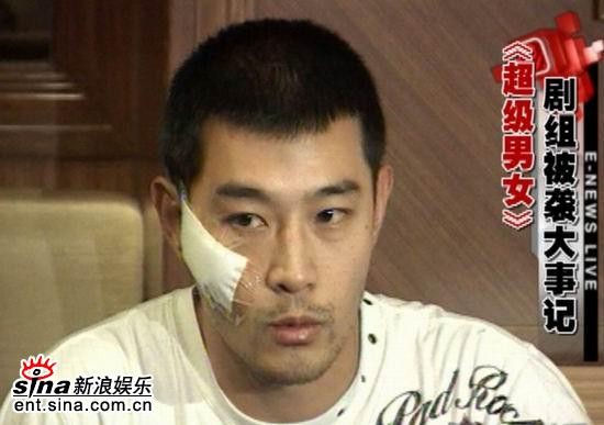 《娱乐现场》预告：黄维德被袭事件新进展(图)