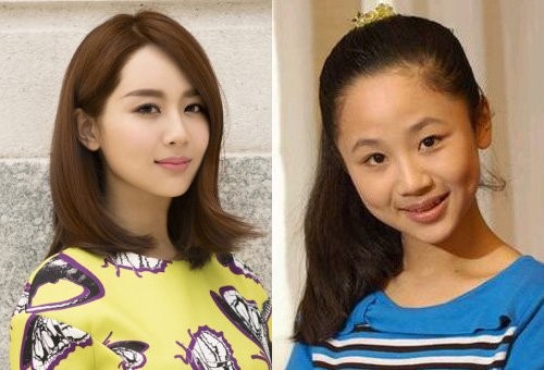 杨紫整容了吗 杨紫整容前后照片