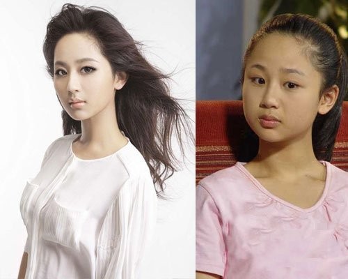 杨紫整容了吗 杨紫整容前后照片