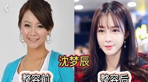 顶级奶茶0d：娱乐圈的颜值变迁史向来是吃瓜群众的快乐源泉，今天带大家围观五位女星的蜕变轨迹。

沈梦辰当年顶着湖南台新人标签出道时，颧骨突出下巴圆钝，如今面部线条像被PS液化过似的流畅，苹果肌恰到好处地饱满，鼻梁挺得能滑滑梯，连发际线都变成了教科书级别的花瓣形。

建议她去开个《骨相调整大师课》，绝对能成内娱爆款。

张韵艺的变脸过程堪称精细化管理，早年略显粗糙的五官经过微调变得精致立体，但那双灵...
