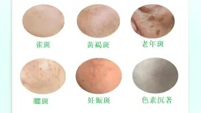 //china-cms.oss-accelerate.aliyuncs.com/-164.png?x-oss-process=image/resize,m_mfit,w_248,h_165/format,webp