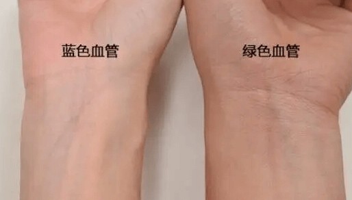 怎么判断自己肤色是黄皮还是白皮插图(1)