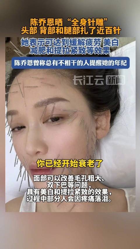 陈乔恩回应全身针雕保养法 ：你问我疼吗？你说呢？
