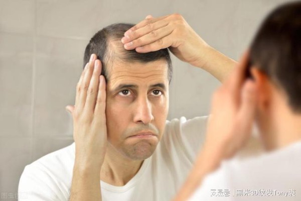 脱发严重？可能是这些生活习惯在作祟，纹发解决严重脱发困扰
