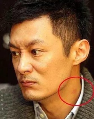 一不小心暴露吻痕的明星，热恋期的明星被抓包的尴尬
