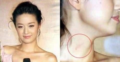 一不小心暴露吻痕的明星，热恋期的明星被抓包的尴尬【图】