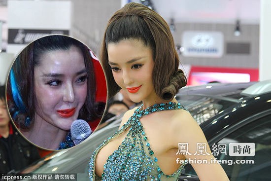 美丽的代价：李颖芝整容后遗症吓坏网友