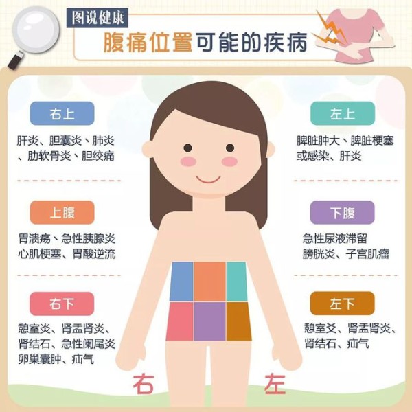 一张图就看懂，腹痛位置可能的疾病