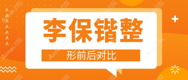 李保锴做鼻子出名实锤！鼻修复/假体隆鼻技术稳到离谱，轻松拿捏高挺美鼻