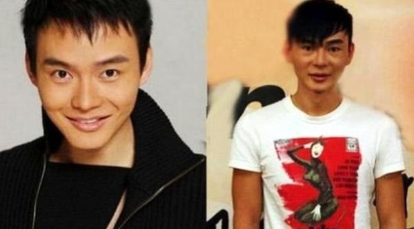 盘点:那些整容失败奇丑无比的男明星