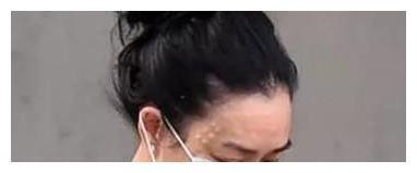 又一女星整容失败，满脸整容痕迹，明星脸整成了网红脸