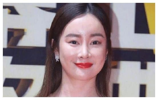 又一女星整容失败，满脸整容痕迹，明星脸整成了网红脸