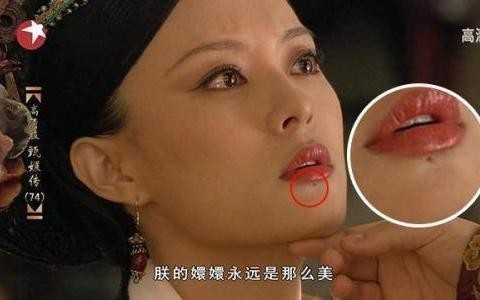 明星脸上的疤痕是怎么回事? 洪金宝的那道疤痕没人敢说