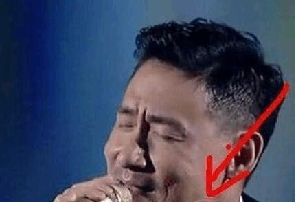明星脸上的疤痕是怎么回事? 洪金宝的那道疤痕没人敢说