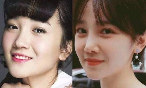 有审美基础的明星整容什么样，看看她们，整完事业颜值双丰收！