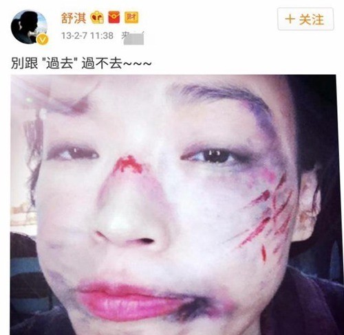 性感女神舒淇，也曾在微博上放出自己一张被虐待后的照片，网友们纷纷表示，这和毁容有什么两样?