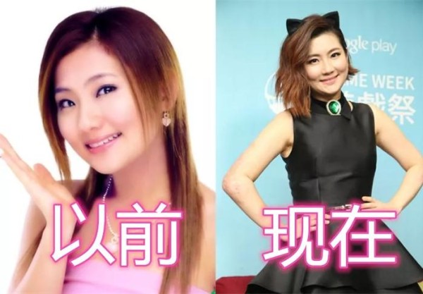 曾惨遭“毁容”的明星，胡歌车祸，俞灏明烧伤，而他却遭人嘲笑！