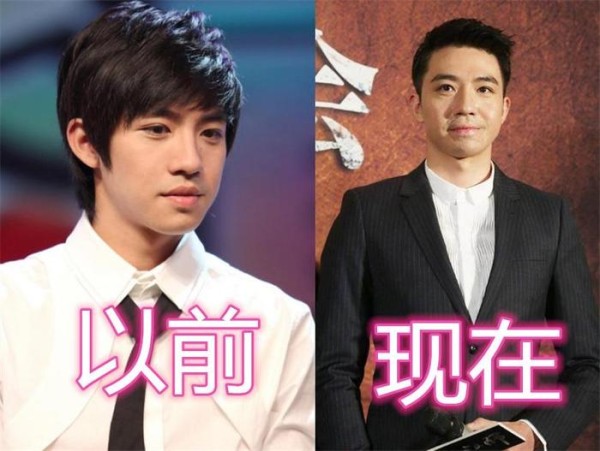 曾惨遭“毁容”的明星，胡歌车祸，俞灏明烧伤，而他却遭人嘲笑！