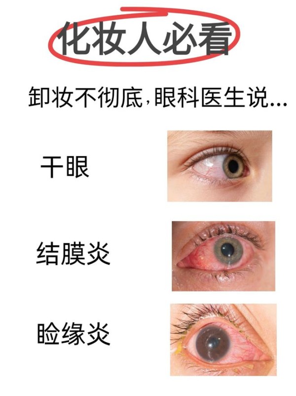 化妆的姐妹注意❗卸妆不彻底，眼科医生说...