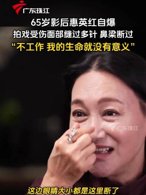 65岁影后惠英红自爆拍戏受伤经历,鼻梁断裂:“不工作,我的生命就没有意义”