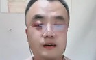 追梦说:宽哥出来喊啥的都有，太尴尬了