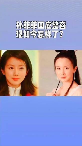 孙菲菲整容风波现状如何？