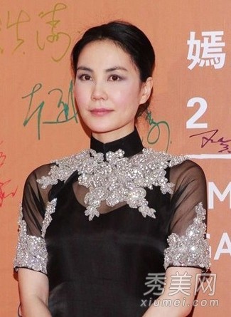 娱乐圈常用10大整形术 女星亲身示范（图）