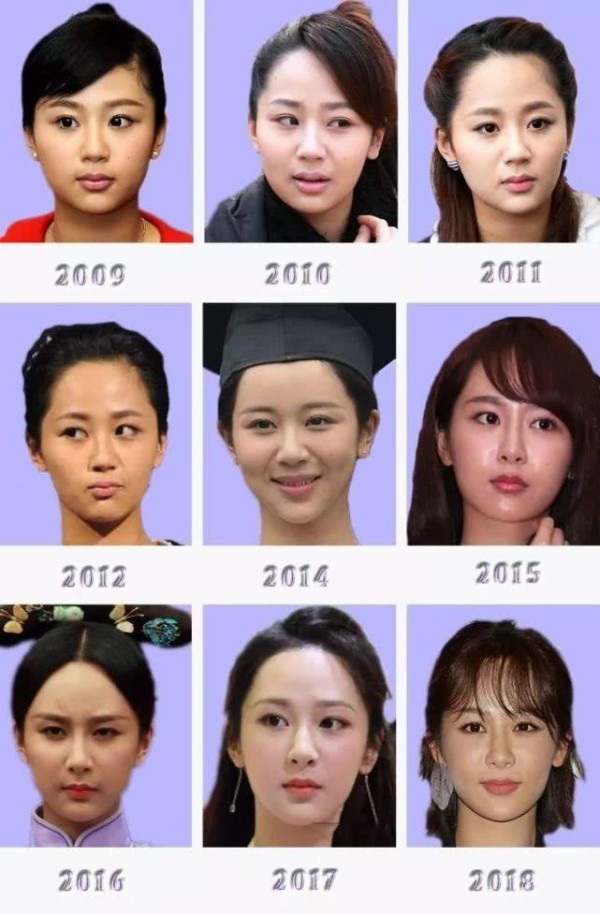 惨遭打脸?杨紫秘密出入整形医院被拍,本人曾多次否认整容