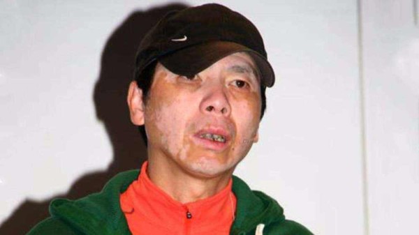 有疾病的明星,有疾病的明星，如何看待明星健康问题