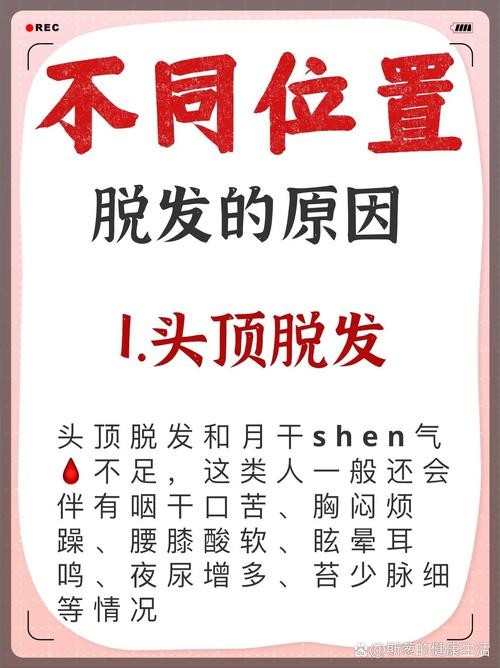 香蕉减脂__香蕉减肥食谱精力充沛轻松瘦
