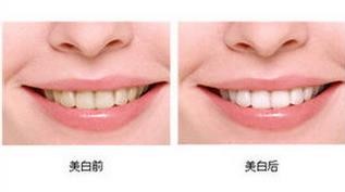 皓齿的真实案例