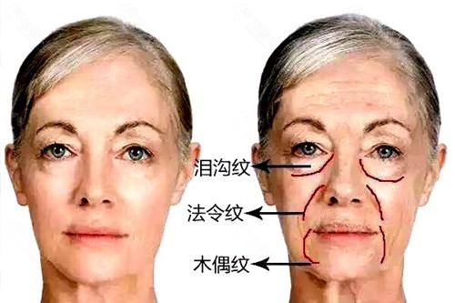 细胞疗法，是“抗衰黑科技”还是“惊天大骗局”呢