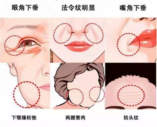 体内细胞减少是造成皮肤衰老的根本原因