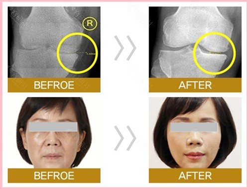 细胞抗衰老到底有没有作用？